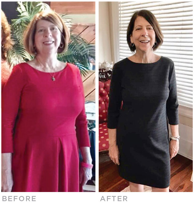 audrey-before-after