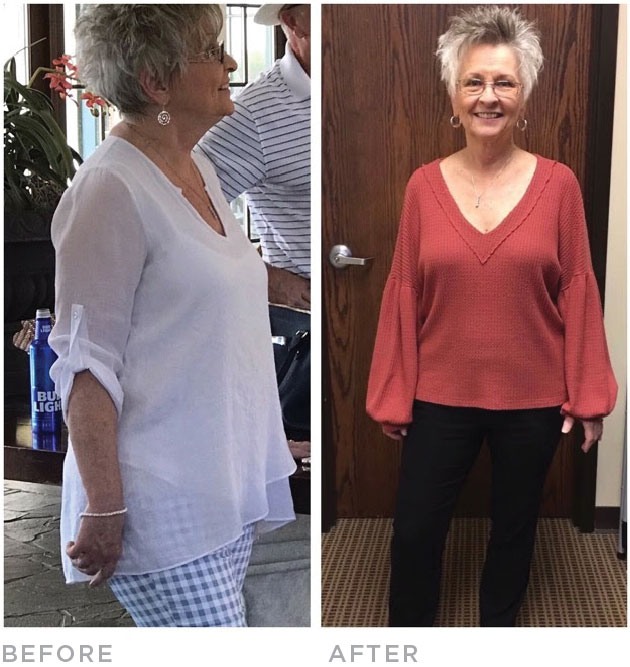 bonnie-before-after