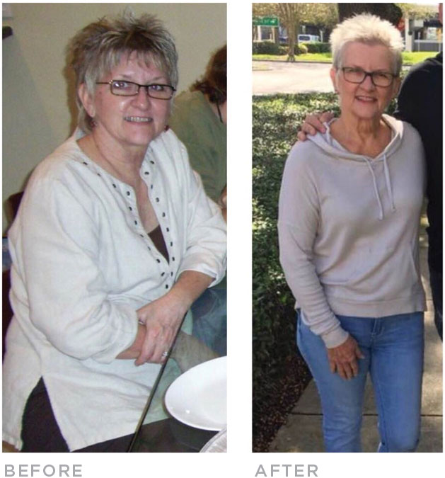 cheryl-before-after