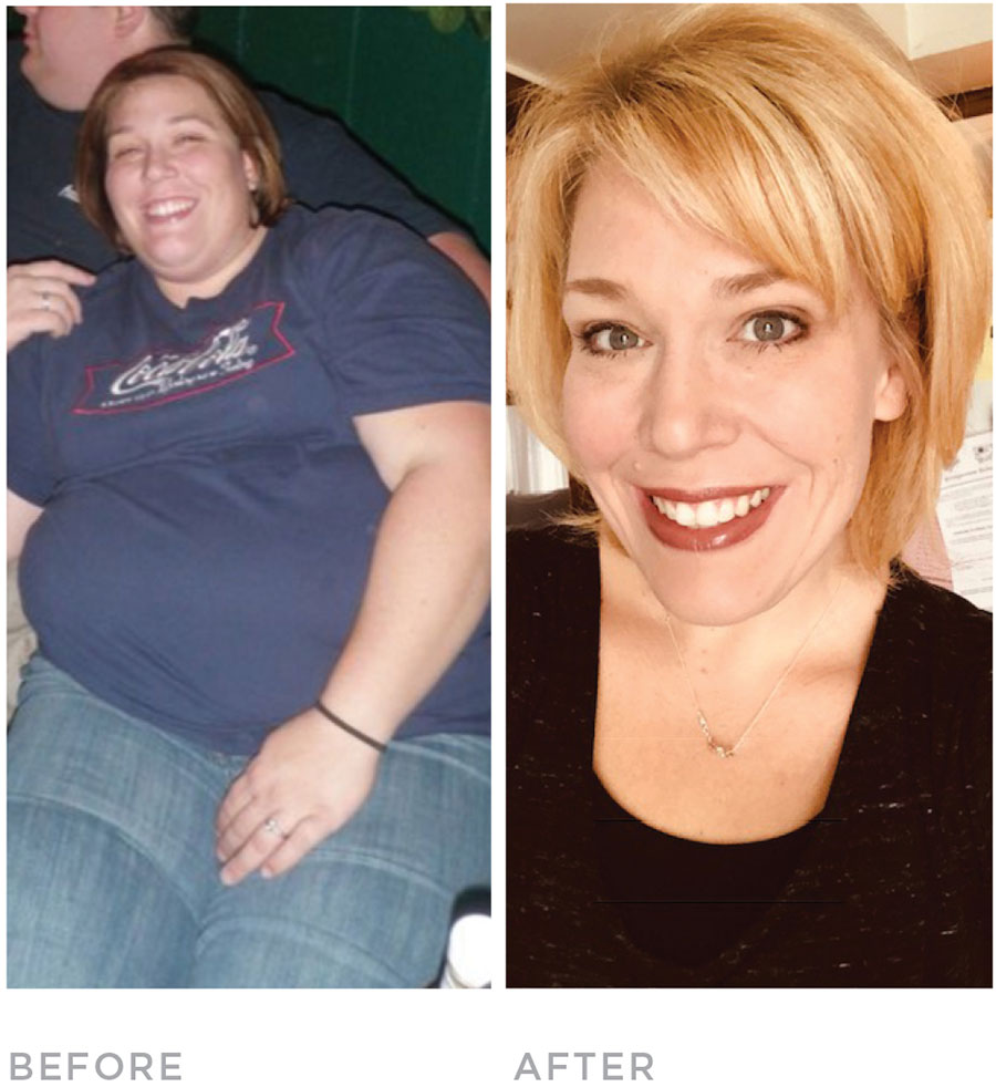 cynthia-before-after