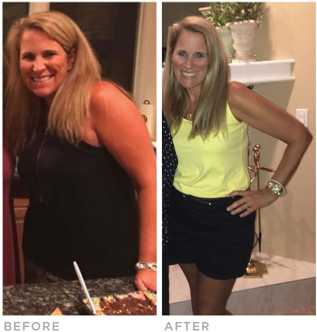 jill-before-after