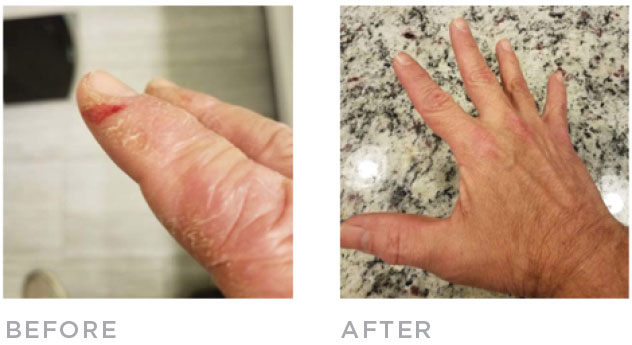 jim-before-after