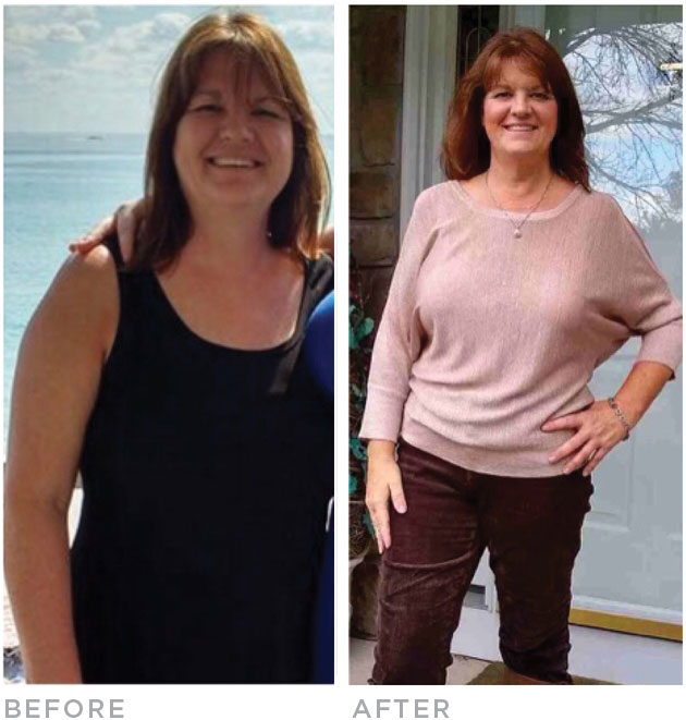 lisa-before-after