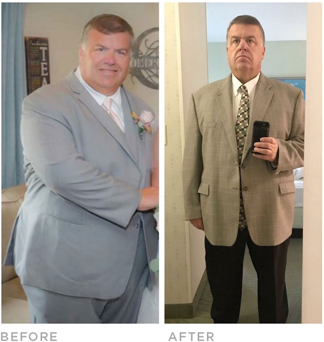 mike-before-after