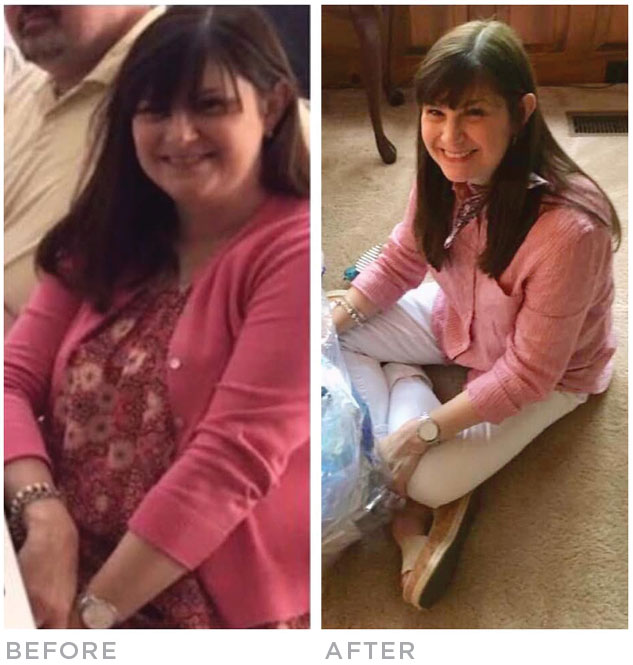 robin-before-after