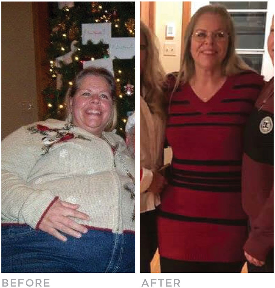 theresa-before-after